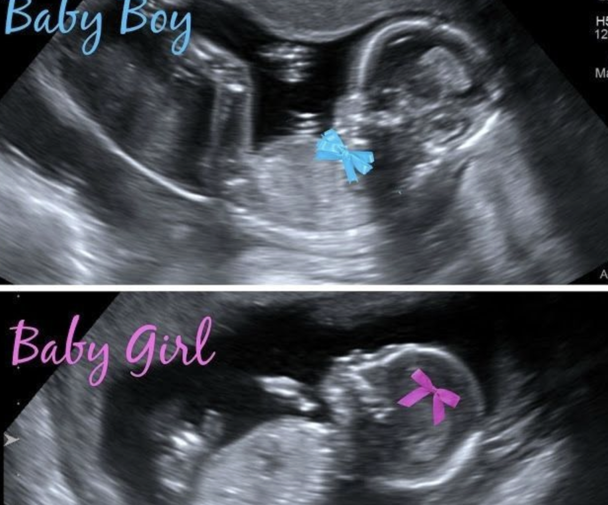 Illustratie bij: Je 13-wekenecho uploaden in ChatGPT om te kijken of het een jongen of meisje is: is het veilig?